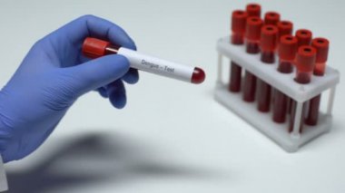 Dang testi, tüp, laboratuvar araştırma, sağlık muayenesi doktor gösteren kan örneğinde