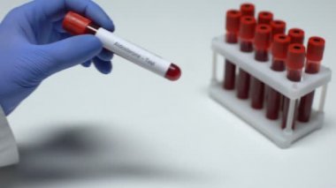 Aldosteron, tüp, laboratuvar araştırma, sağlık muayenesi doktor gösteren kan örneğinde