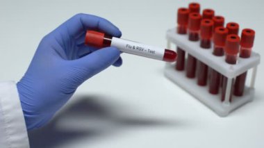 Grip ve Rsv, tüp, laboratuvar araştırma, sağlık muayenesi doktor gösteren kan örneğinde