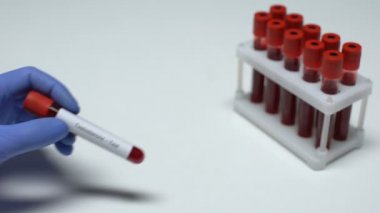 Testosteron, tüp, laboratuvar araştırma, sağlık muayenesi doktor gösteren kan örneğinde