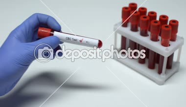 Negatif kan sayımı testi, Doktor gösteren kan örneği, laboratuvar araştırma, sağlık check-up
