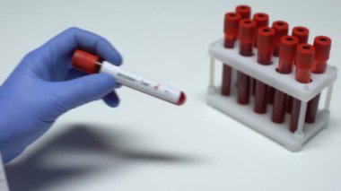 Negatif amilaz testi, Doktor gösteren kan örneği, laboratuvar araştırma, sağlık check-up