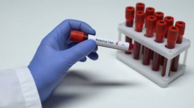 Negatif Rotavirüs testi, Doktor gösteren kan örneği tüp, sağlık check-up
