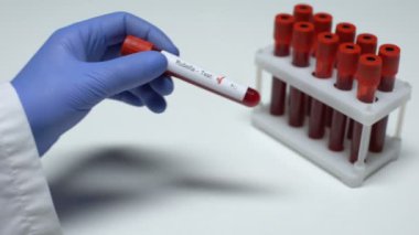 Negatif Rubella testi, Doktor gösteren kan örneği, laboratuvar araştırma, sağlık check-up