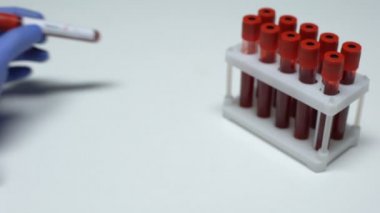 Negatif sıtma testi, Doktor gösteren kan örneği, laboratuvar araştırma, sağlık check-up