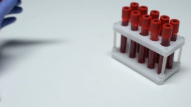 Negatif amonyak testi, tüp, laboratuvar araştırma, sağlık doktor gösteren kan örneğinde