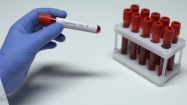 Negatif Toxoplasma testi, Doktor gösteren kan örneği tüp, sağlık check-up