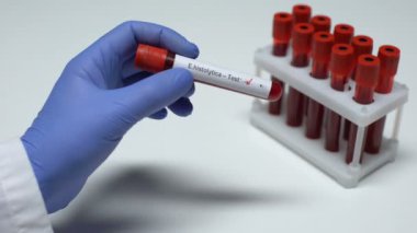 Negatif E histolytica testi, Doktor gösteren kan örneği tüp, laboratuvar araştırma