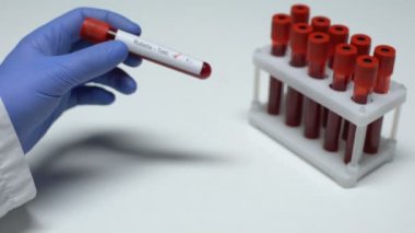 Kızamıkçık testi, Doktor gösterilen kan örneği, laboratuar araştırmaları, sağlık muayenesi