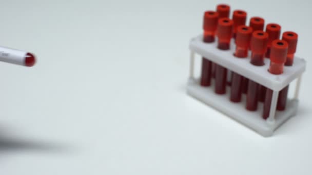 Teste de varíola, médico mostrando amostra de sangue em tubo, pesquisa de laboratório, exame de saúde — Vídeo de Stock