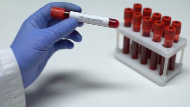 HIV-vírus terhelés, orvos azt mutatja, vért cső, laboratóriumi, egészségügyi szűrés — Stock videók