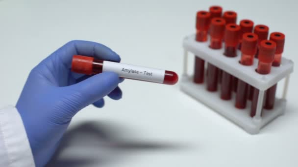 Амилазный тест, доктор показывает образец крови в трубке, лабораторные исследования, медицинский осмотр — стоковое видео