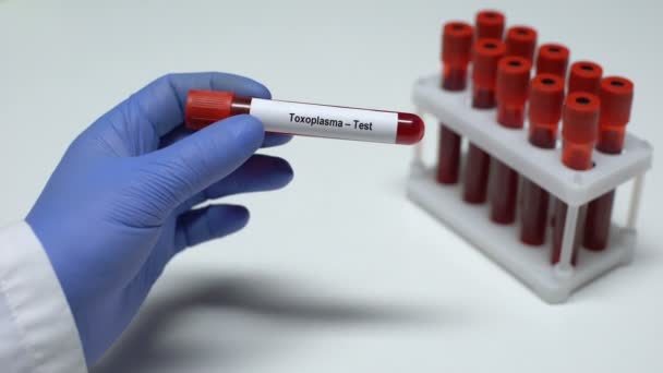Toxoplasma, dokter menunjukkan sampel darah dalam tabung, penelitian laboratorium, pemeriksaan kesehatan — Stok Video