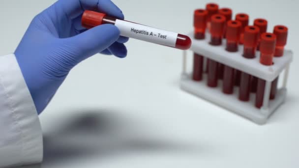 Гепатит А, доктор, показывающий образец крови в трубке, лабораторные исследования, медицинский осмотр — стоковое видео