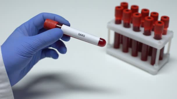 Test della SARS, medico che mostra il campione di sangue in tubo, ricerca di laboratorio, controllo dello stato di salute — Video Stock