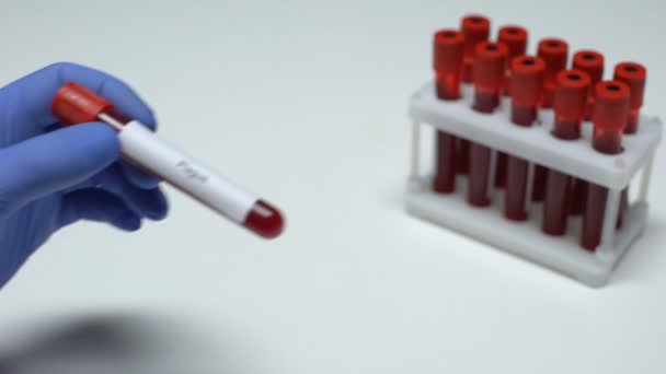 Pesten, läkare visar blodprov i tube, lab forskning, hälsokontroll — Stockvideo