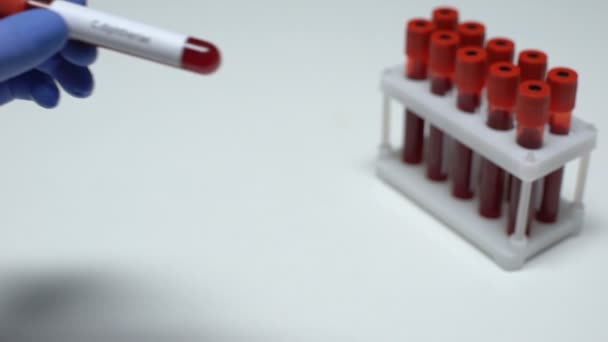 C difteri, dokter menunjukkan sampel darah dalam tabung, penelitian laboratorium, pemeriksaan kesehatan — Stok Video