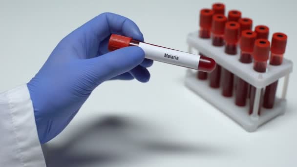 Тест на малярию, доктор показывает образец крови в трубке, лабораторные исследования, медицинский осмотр — стоковое видео