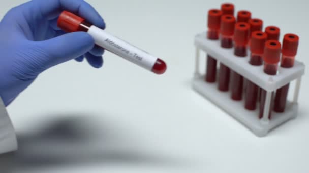 Aldosterona, médico mostrando amostra de sangue em tubo, pesquisa de laboratório, exame de saúde — Vídeo de Stock