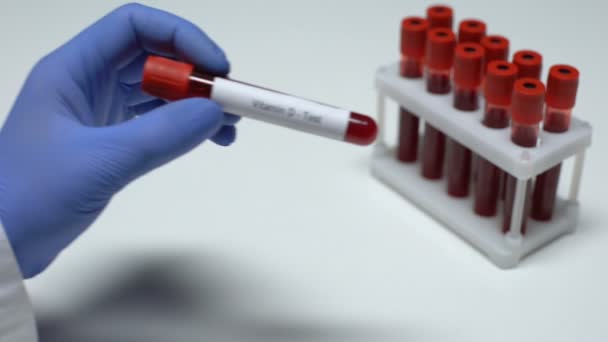 Vitamín D, lékař zobrazeno vzorku krve do zkumavky, laboratorní výzkum, zdravotní vyšetření — Stock video