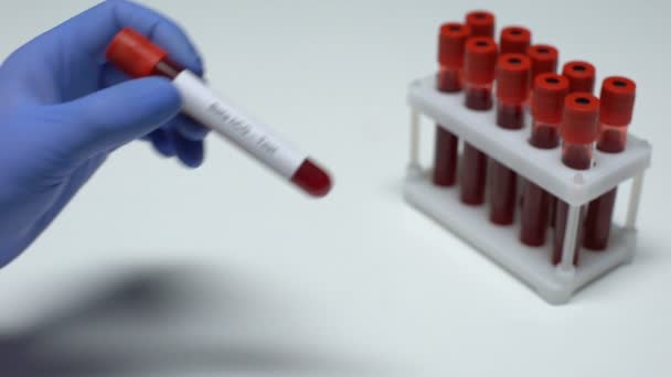 Бета-ХГЧ тест, доктор показывает образец крови в трубке, лабораторные исследования, медицинский осмотр — стоковое видео