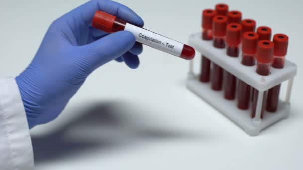 Koagulace, lékař zobrazeno vzorku krve do zkumavky, laboratorní výzkum, zdravotní vyšetření
