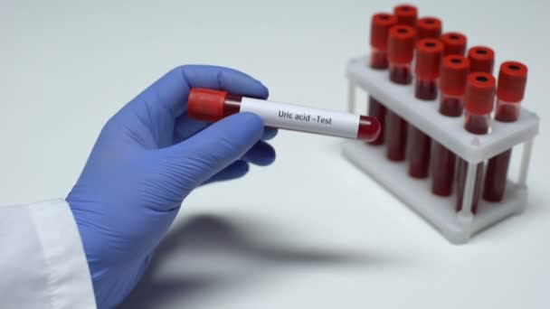 Мочевая кислота, врач показывает анализ крови в пробирке, лабораторные исследования, проверка здоровья — стоковое видео