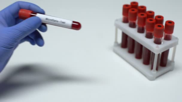 Microfilaria, médico mostrando muestra de sangre en tubo, investigación de laboratorio, chequeo de salud — Vídeos de Stock