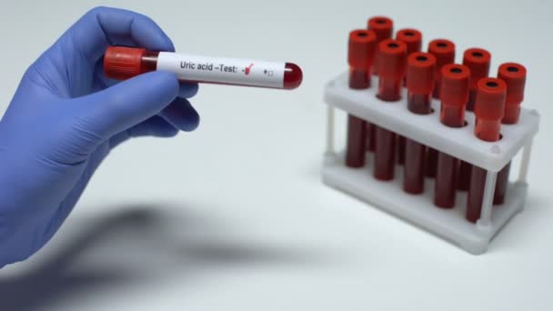 Negativ Uric acid test, läkare visar blodprov, lab forskning, hälsokontroll — Stockvideo