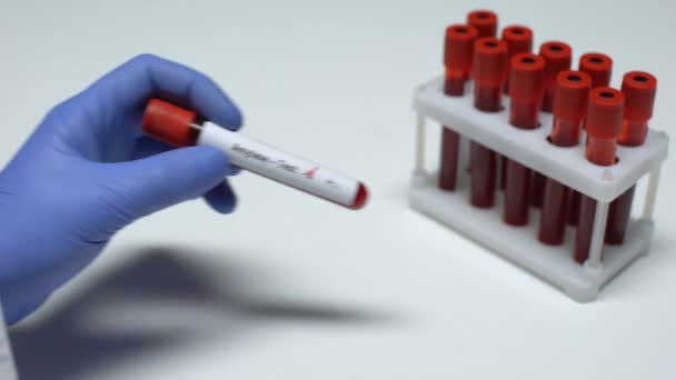 Отрицательный анализ амилазы, доктор показывает образец крови, лабораторные исследования, медицинский осмотр — стоковое видео