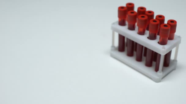Negativer Kryptokokken-Test, Arzt zeigt Blutprobe im Röhrchen, Gesundheitsprüfung — Stockvideo