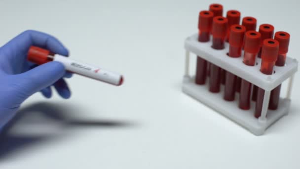 Teste MERS-CoV negativo, médico mostrando amostra de sangue em tubo, exame de saúde — Vídeo de Stock