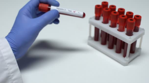 Tes Hepatitis D negatif, dokter menunjukkan sampel darah dalam tabung, penelitian laboratorium — Stok Video