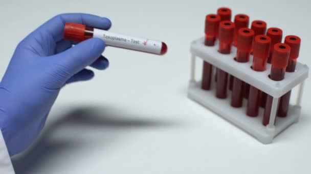 Testul toxicoplasmatic negativ, medicul care prezintă proba de sânge în tub, verificarea sănătății — Videoclip de stoc