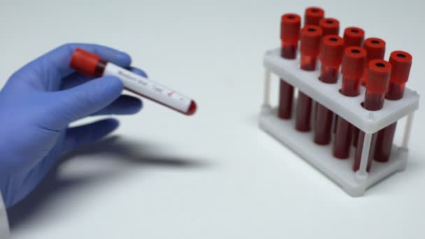Teste de Western blot negativo, médico mostrando amostra de sangue em tubo, exame de saúde — Vídeo de Stock