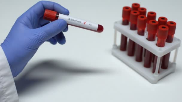 Отрицательный тест на аденовирус, доктор показывает образец крови в трубке, лабораторные исследования — стоковое видео