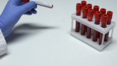 Pozitif C diphtheriae test, Doktor gösteren kan örneği tüp, laboratuvar araştırma