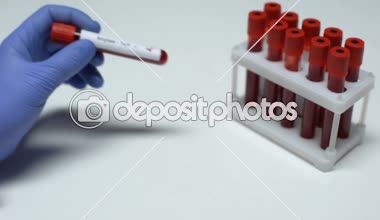 Pozitif amilaz test, Doktor gösterilen kan örneği, laboratuvar araştırma, sağlık muayenesi