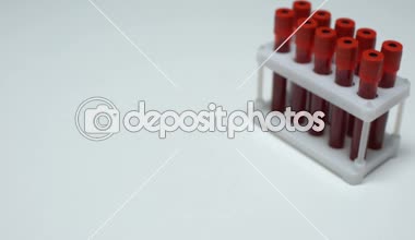 Pozitif Western blot testi, kan örneği tüp, laboratuvar araştırma gösteren doktor