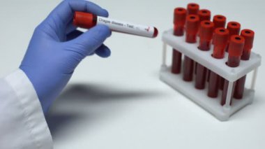 Pozitif Chagas hastalığı test, Doktor gösteren kan örneği tüp, laboratuvar araştırma