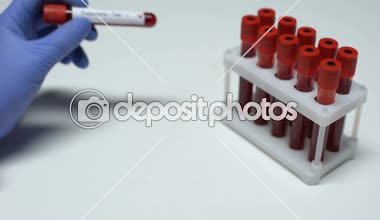 Pozitif talasemi testi, Doktor gösteren kan örneği tüp, sağlık check-up