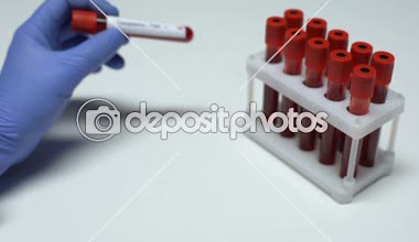 Pozitif Toxoplasma test, Doktor gösteren kan örneği tüp, laboratuvar araştırma