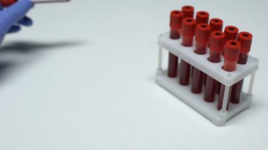 Pozitif gribi Rsv test, Doktor gösterilen kan örneği, laboratuvar araştırma, sağlık muayenesi