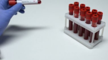 Pozitif İspanyol gribi testi, kan örneği tüp, sağlık check-up gösterilen doktor