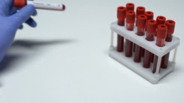 Pozitif Paratiroid testi, Doktor gösteren kan örneği tüp, sağlık check-up