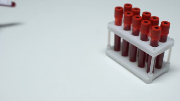 Teste de ácido úrico positivo, médico mostra amostra de sangue, pesquisa de laboratório, exame de saúde — Vídeo de Stock