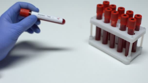 Test positif à l'amylase, médecin montrant un échantillon de sang, recherche en laboratoire, bilan de santé — Video