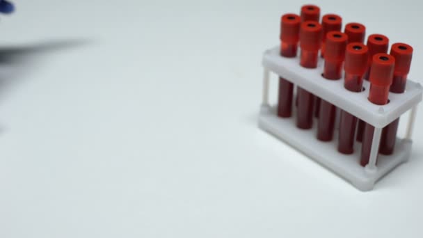 Teste CBC positivo, médico mostrando amostra de sangue, pesquisa de laboratório, exame de saúde — Vídeo de Stock
