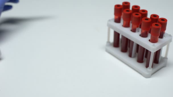 Positieve test op leukemie, arts weergegeven: bloedmonster in buis, gezondheid checkup — Stockvideo