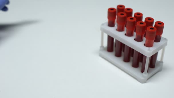 Test di piombo positivo, medico che mostra il campione di sangue, ricerca di laboratorio, controllo dello stato di salute — Video Stock